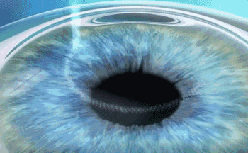 1602488718137888.gif 3.gif